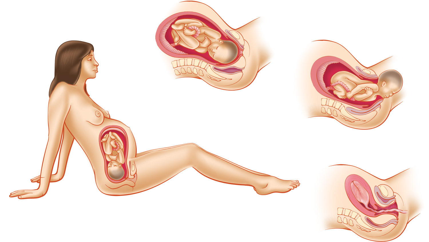 Color illustration of a woman giving birth. 
